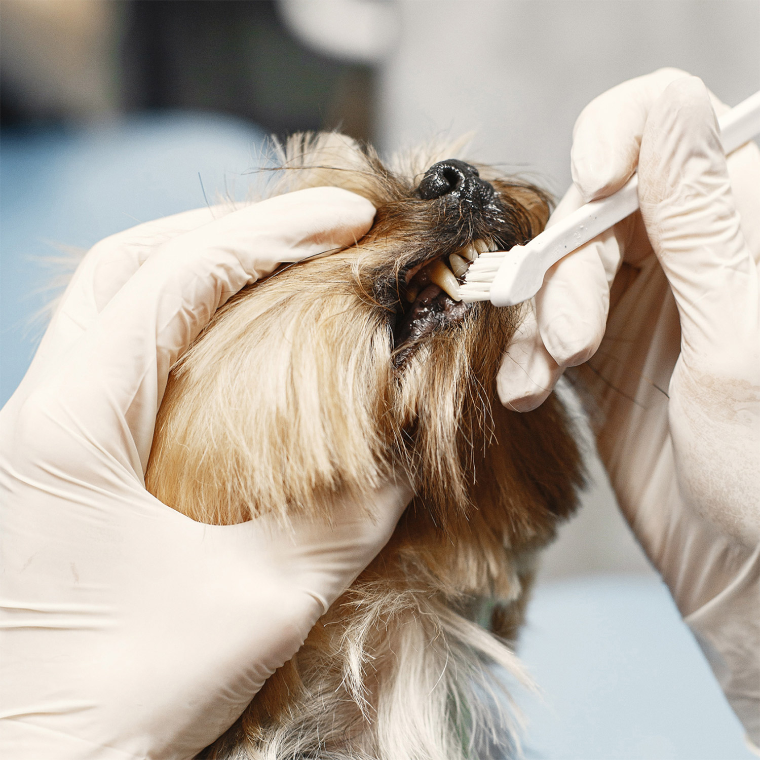 Tooth Extraction